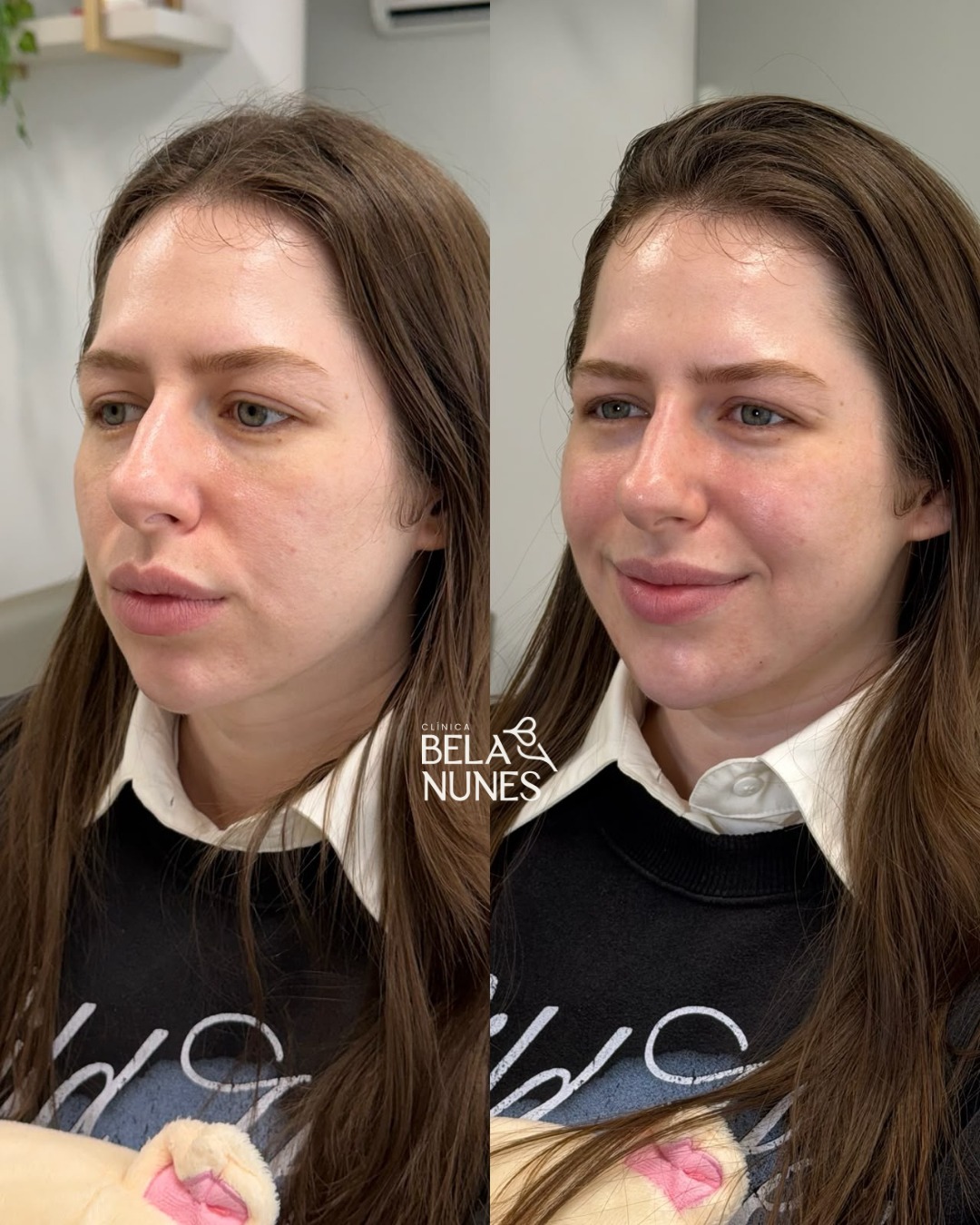 Resultado 8: antes e depois
