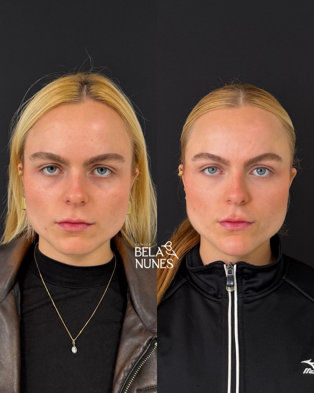Resultado 9: antes e depois