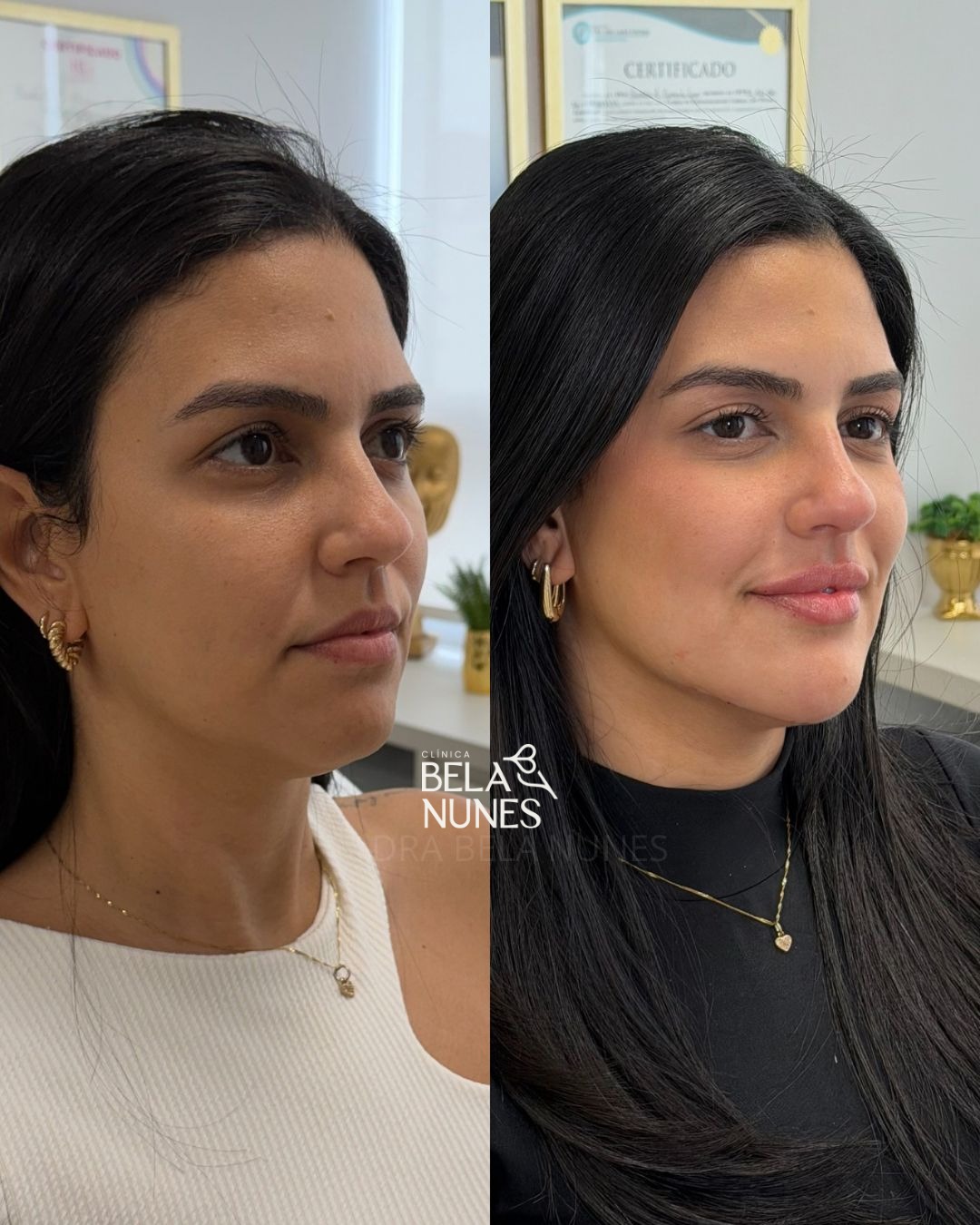 Resultado 11: antes e depois