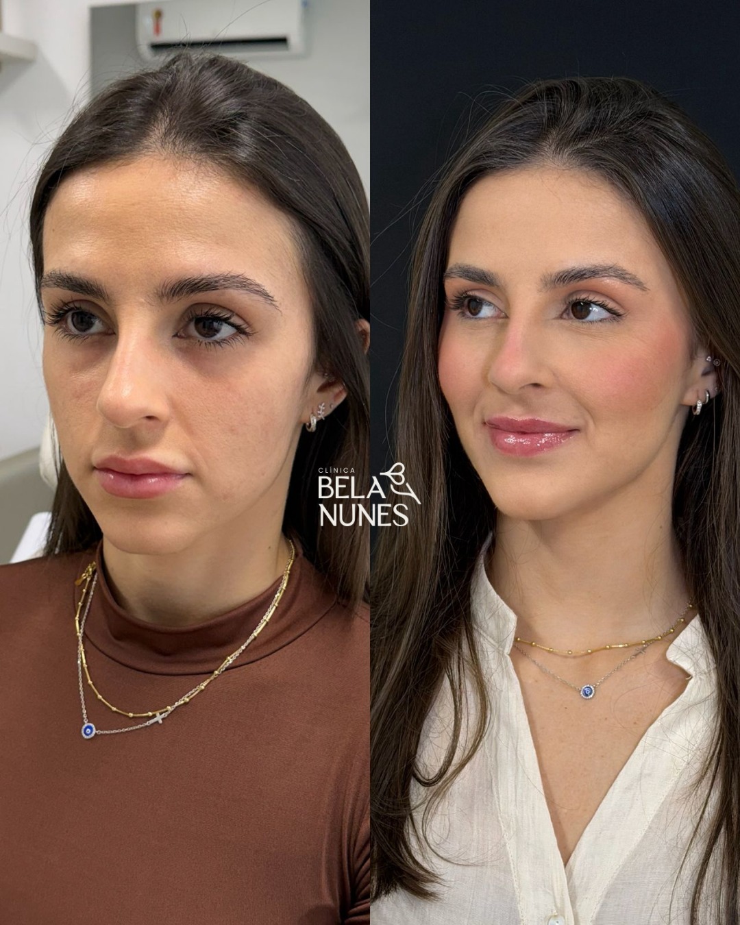 Resultado 13: antes e depois