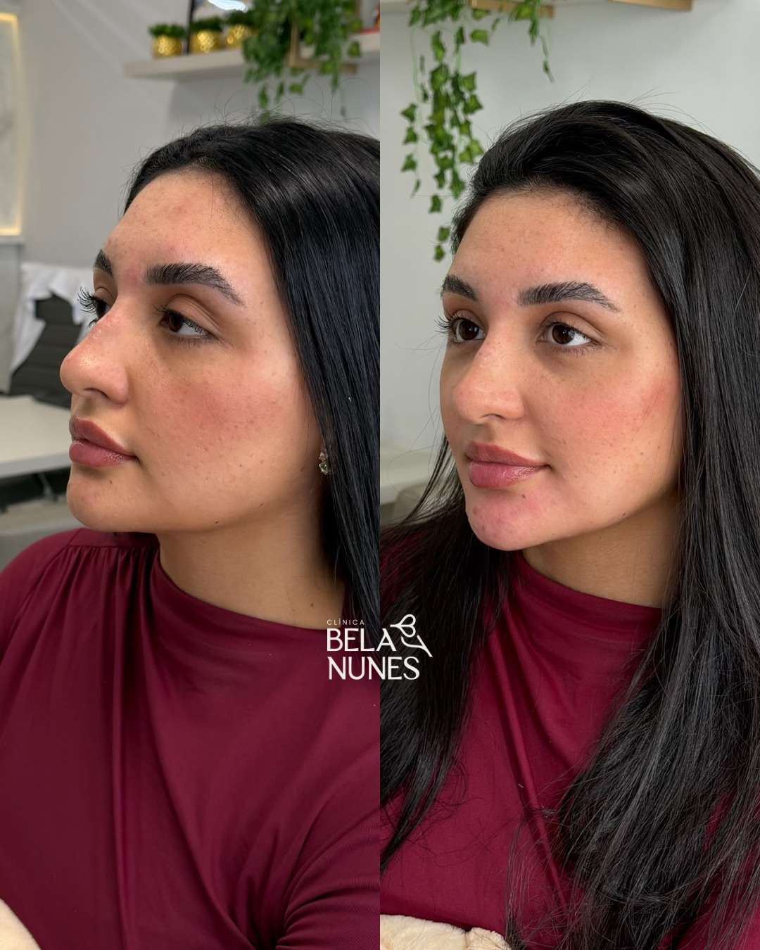 Resultado 14: antes e depois