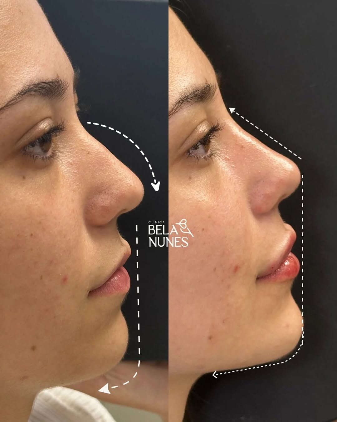 Resultado 15: antes e depois