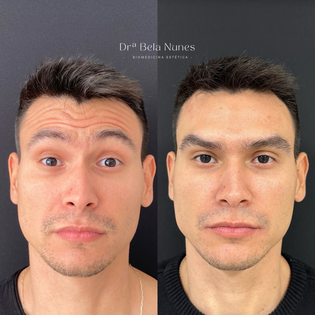 Resultado 19: antes e depois